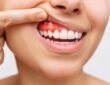 Understanding Gum Disease: Signs, Symptoms, and Treatment Options