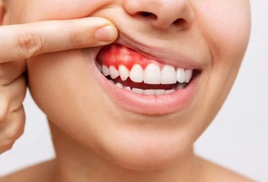 Understanding Gum Disease: Signs, Symptoms, and Treatment Options