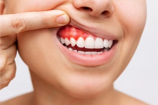 Understanding Gum Disease: Signs, Symptoms, and Treatment Options